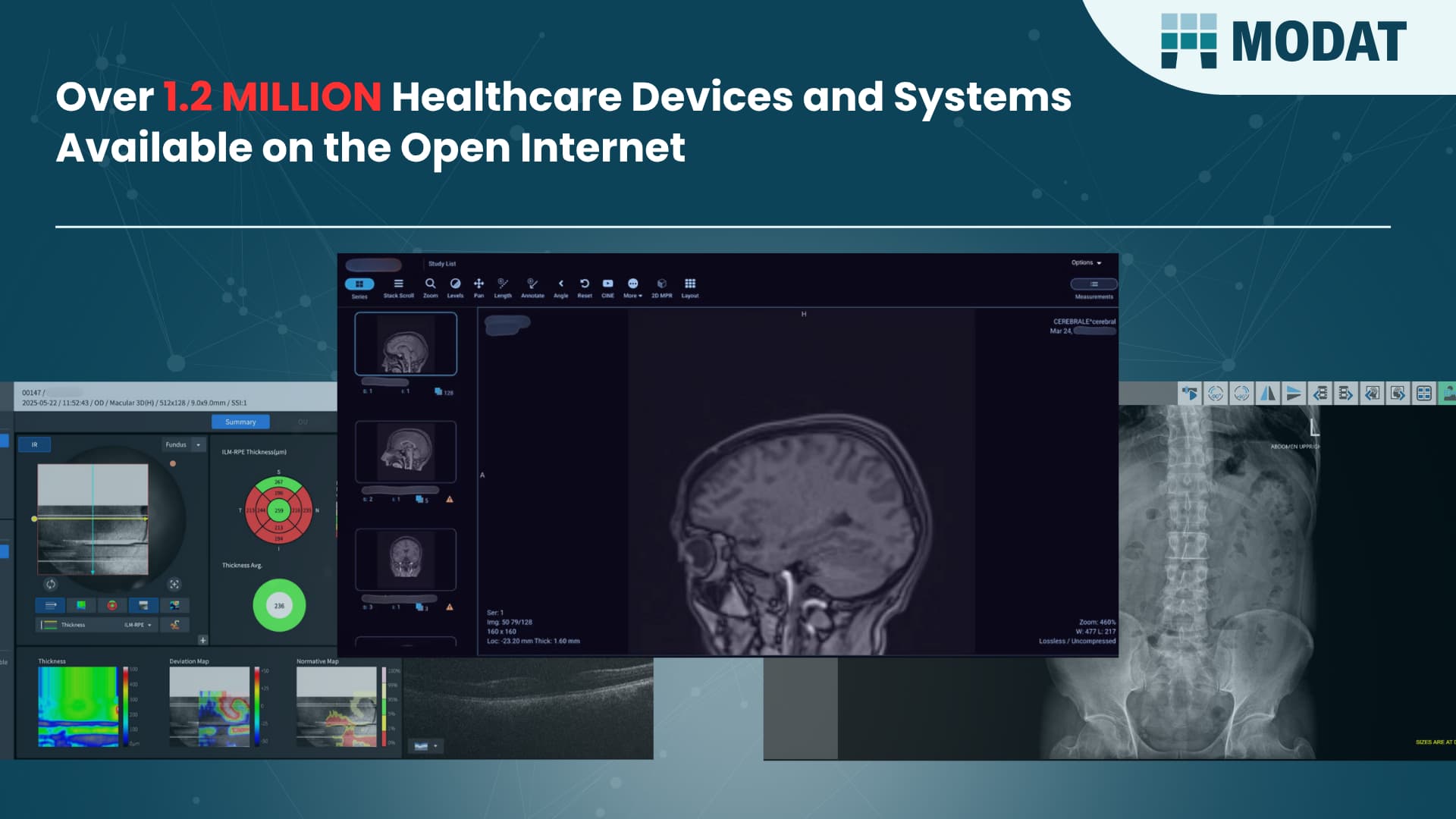 1.2 Million Healthcare Devices Exposed Online, Risking Patient Data