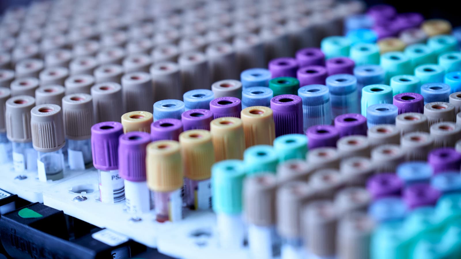 US Lab Testing Provider Exposes Health Data of 1.6 Million People